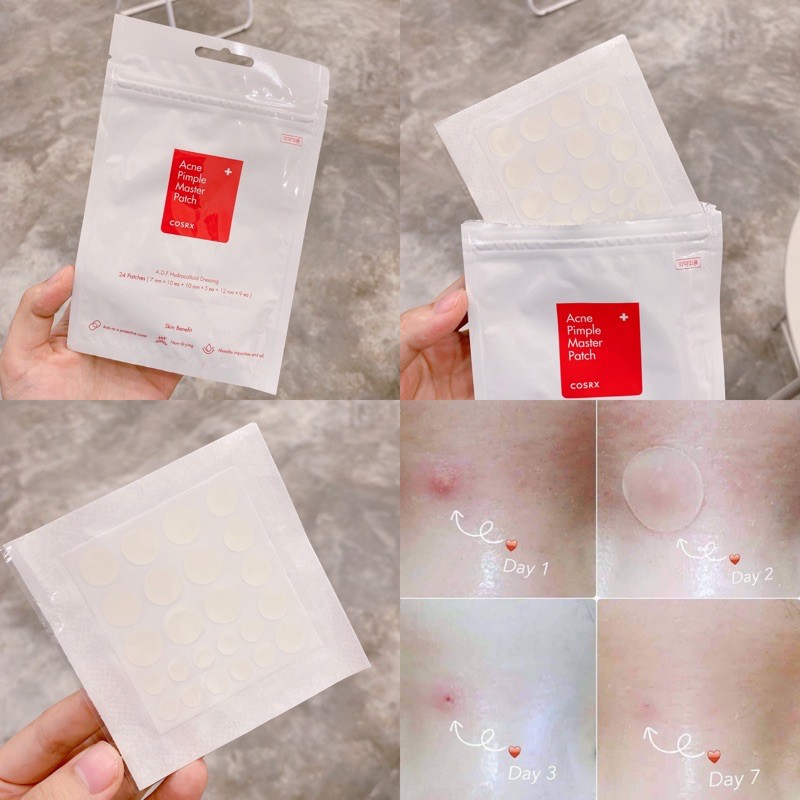 Miếng dán mụn Cosrx Acne Pimple Master Patch 24 miếng (Màu đỏ) và Cosrx The Clear Pit Master Patch 18 miếng (Màu đen)