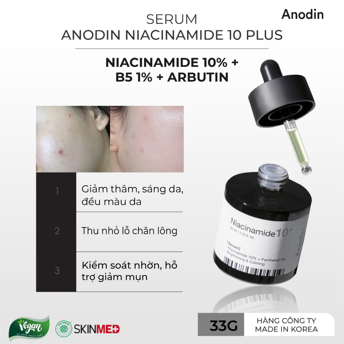 Tinh Chất Serum Dưỡng Trắng Da, Mờ Thâm Nám Anodin Niacinamide 10 Plus Hàn Quốc 33ml