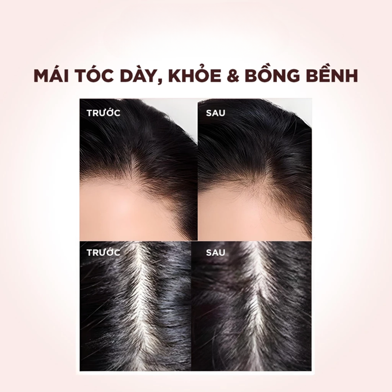Bộ Đôi Dầu Gội - Xả Giảm Gãy Rụng Tóc, Giúp Tóc Chắc Khoẻ L'Oréal Paris Full Resist Pháp 440ml