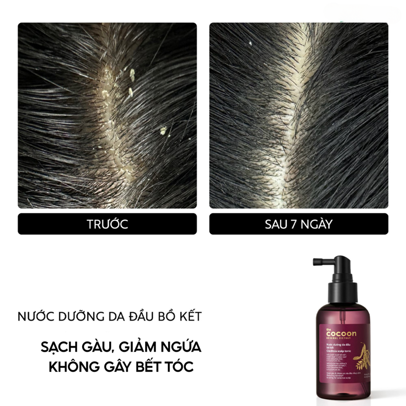Nước Dưỡng Tóc Bồ Kết Thuần Chay Cocoon Giảm Gàu Cho Da Đầu Nhạy Cảm Gleditsia Scalp Tonic 140ml