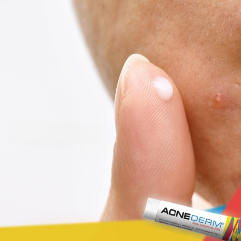 Kem giảm mụn, giảm thâm ACNEDERM Azelaic Aicd 20% Acne Derm 20g