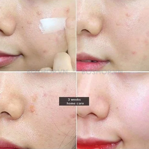 Kem Chống Nắng Rau Má Không Trôi Skin1004 Madagascar Centella Air-Fit Suncream Light SPF 30 PA++++ 50ml ( Da dầu mụn nhạy cảm )