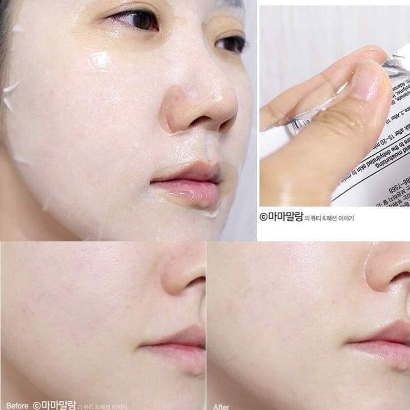 Lẻ 1 Miếng & Combo 10 Miếng Mặt Nạ Giấy BNBG Vita Genic Hàn Quốc