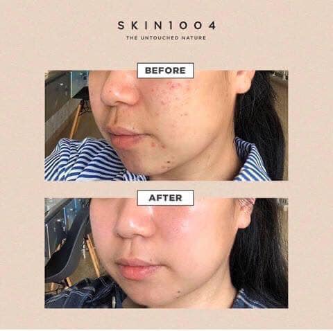 e534 - Tinh Chất Rau Má Skin1004 Madagascar Centella Ampoule 55ml