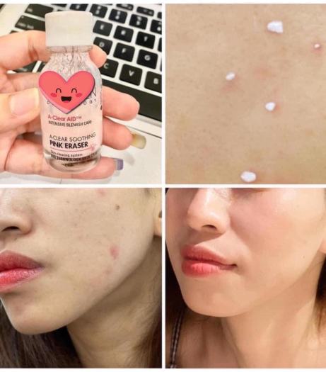 Dung Dịch Chấm Mụn Neogen Dermalogy A-clear Soothing Pink Eraser 15ml