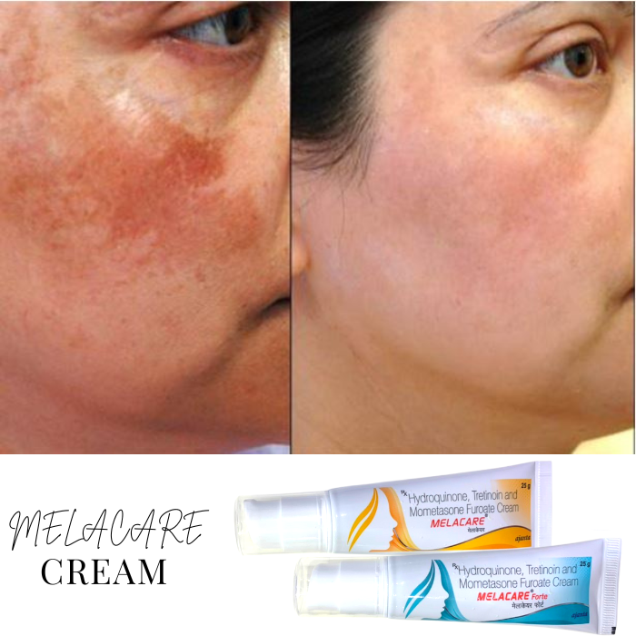 Kem Dưỡng Melacare Ajanta Làm Mờ Thâm Nám, Xóa Tàn Nhang ( màu xanh ) 25g