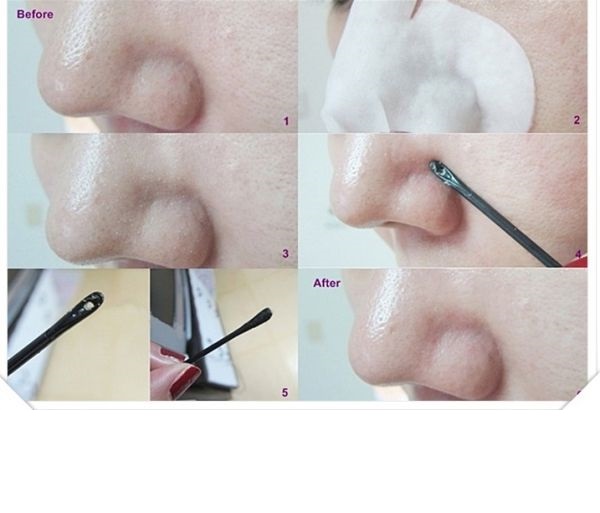 Mặt Nạ Đẩy Mụn dán mụn Đầu Đen Ciracle Goodbye Blackhead Hộp 20 Miếng