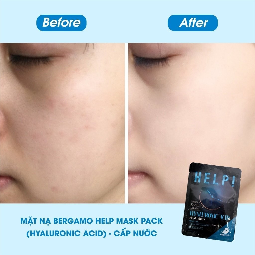 Mặt Nạ Bergamo Help Mask Pack Dưỡng Trắng, Cải Thiện Đàn Hồi Da & Cấp Ẩm Hàn Quốc 25ml