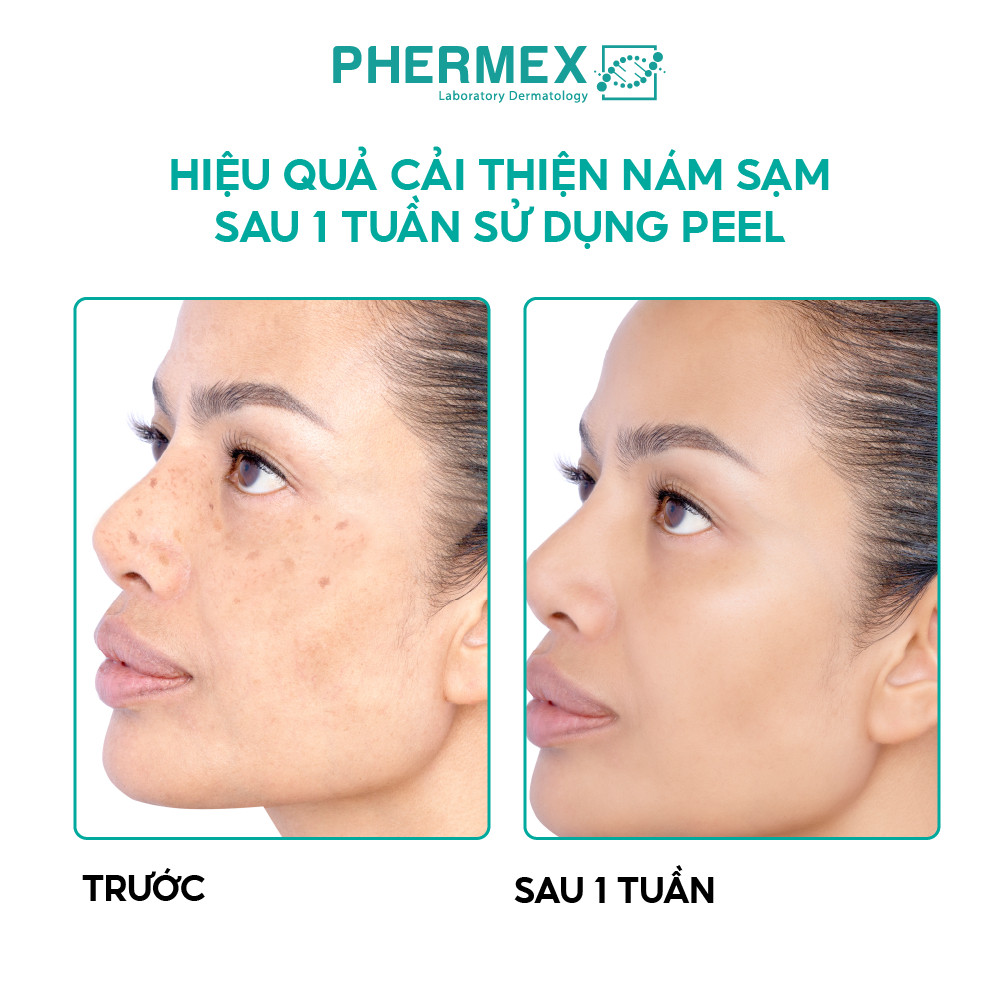 Peel Tế Bào Thế Hệ Mới Tái Sinh Trắng Da Phermex Re.BIO Tech Hỗ Trợ Giảm Mụn, Mờ Thâm Hàn Quốc 1.5g