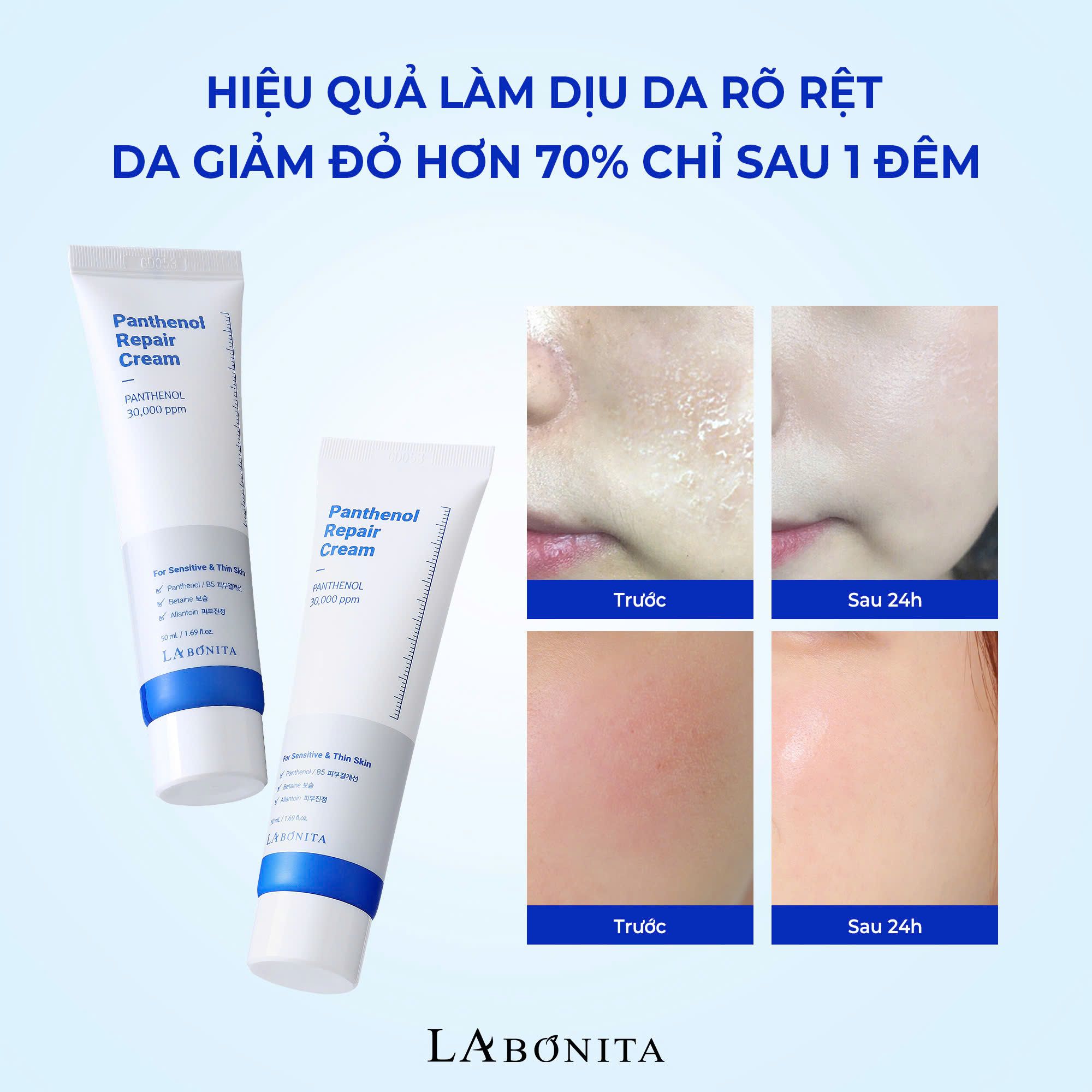 Kem Dưỡng Phục Hồi Vital Panthenol Repair Cream La Bonita 50ML LYO