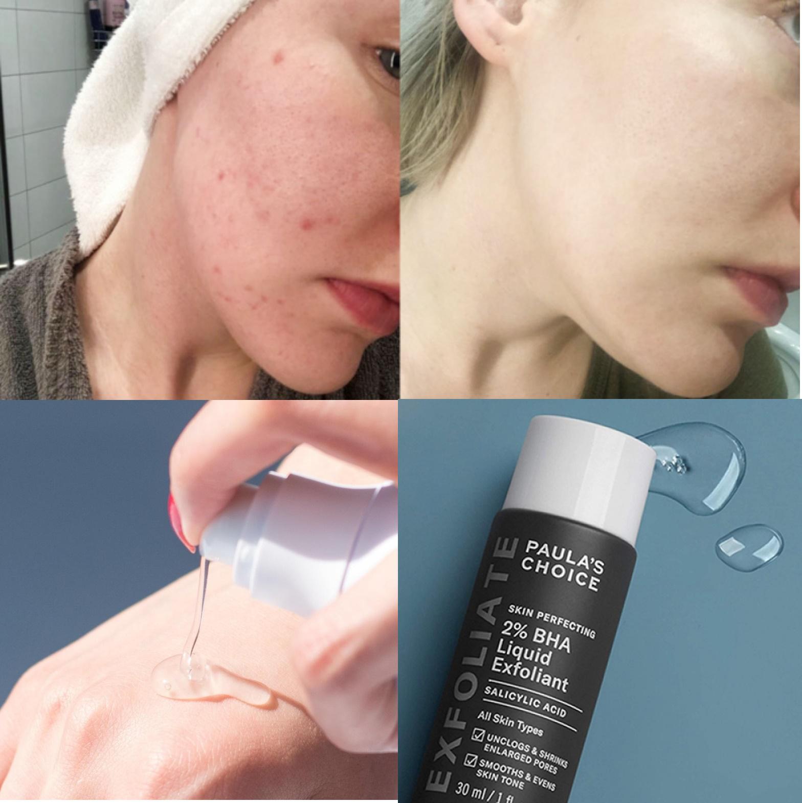 Dung Dịch Tẩy Tế Bào Chết Hóa Học Paula's Choice Skin Perfecting 2% BHA Liquid Exfoliant 30ml
