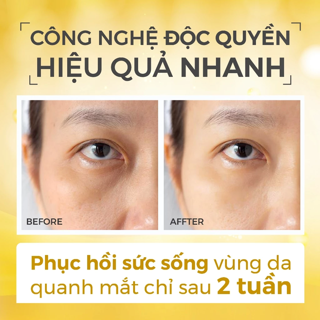 f122 - Kem dưỡng mắt cao cấp Recipe Eye Cream 30g