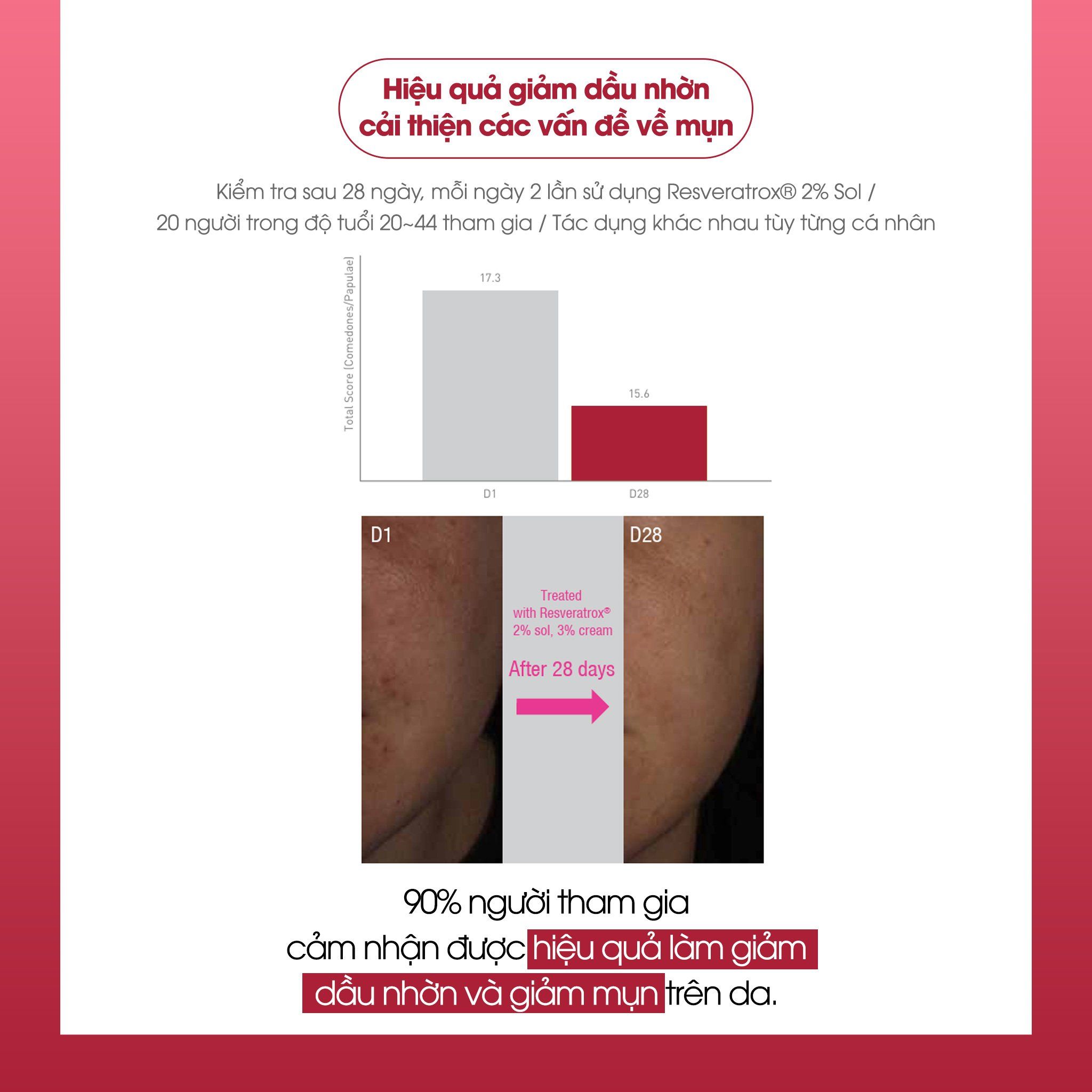 Kem Dưỡng Trẻ Hoá, Căng Bóng Da La Bonita Vita A Retinal Creamy Essence 30ml LYO