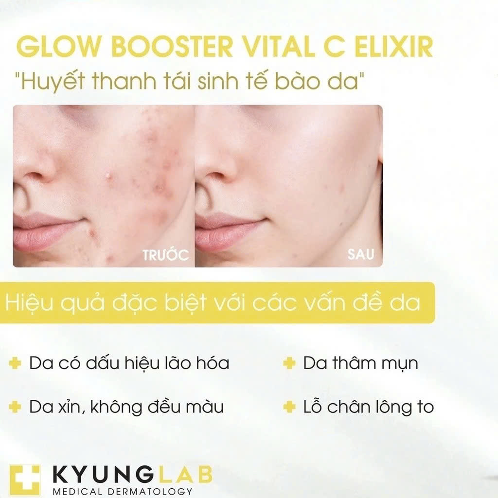 Tinh Chất Serum Vitamin C Kyunglab Glow Booster Vital C Elixir Cấp Ẩm, Giảm Thâm Nám, Dưỡng Trắng Da Hàn Quốc 30ml