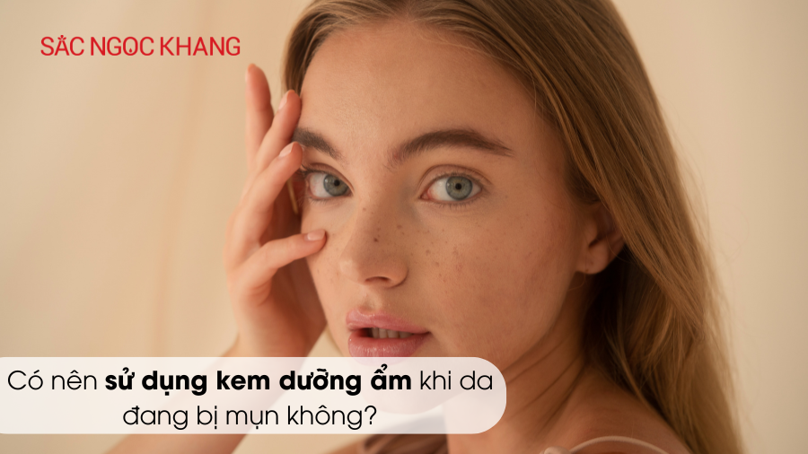 Có nên sử dụng kem dưỡng ẩm khi da đang bị mụn không?