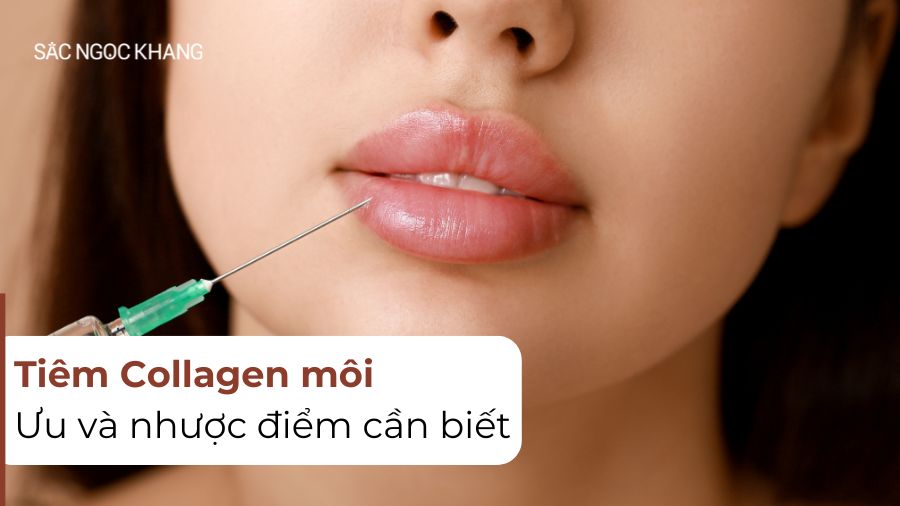 Tiêm collagen môi: Bí quyết để có đôi môi căng mọng tự nhiên