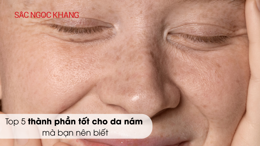 Top 5 thành phần tốt cho da nám mà bạn nên biết
