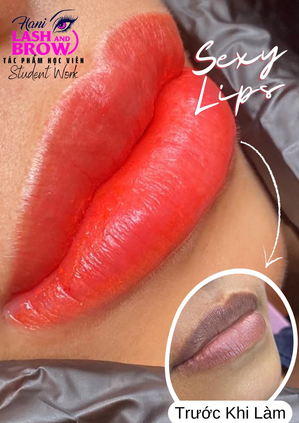 Khử thâm môi có mấy cấp độ? Giải pháp khắc phục hiệu quả? 