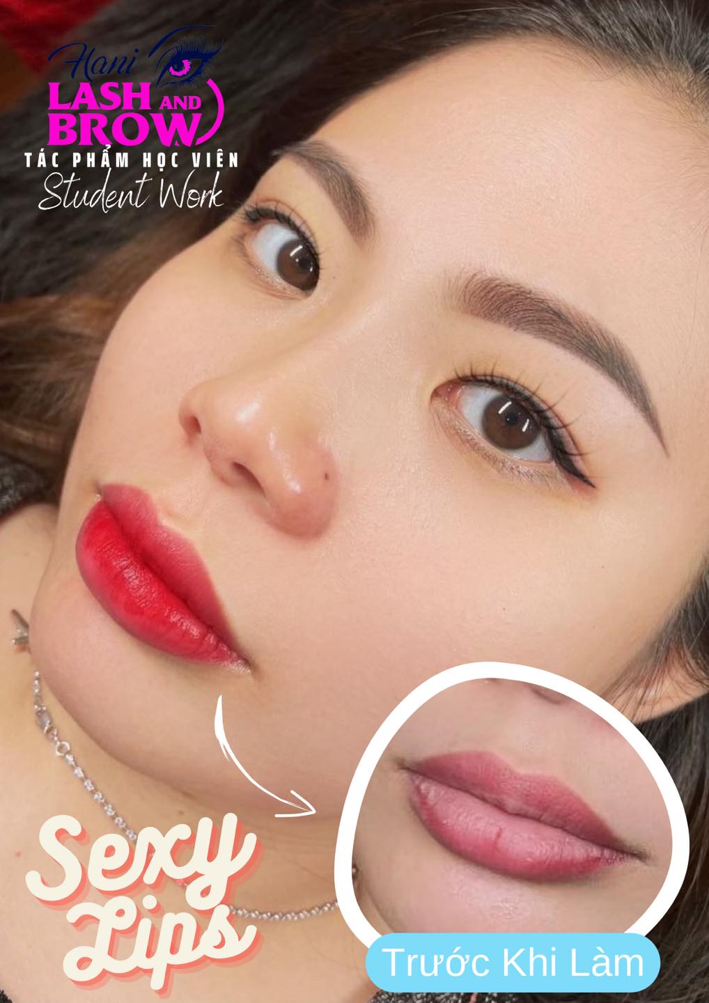 Phun môi Collagen có quy trình phục hồi như thế nào?