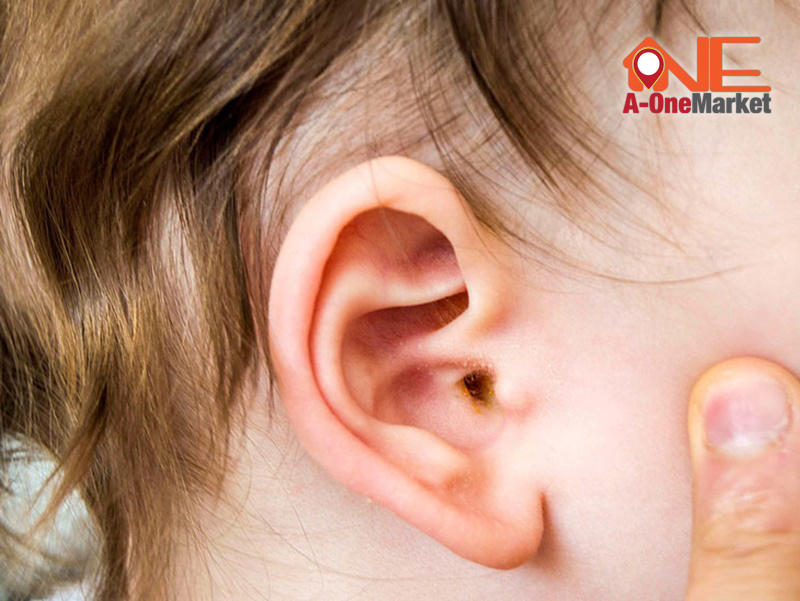 Viêm tai giữa ở trẻ và những nguy hiểm ba mẹ không nên bỏ qua