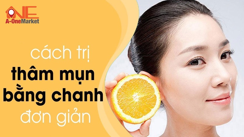  Cách trị thâm mụn bằng chanh