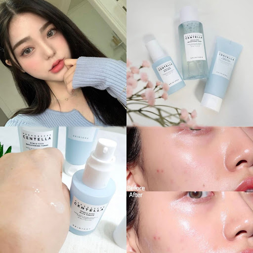 Serum Skin1004 Dưỡng Ẩm, Làm Sáng Da Madagascar Centella Hyalu-Cica Blue  Serum 50ml | Lala Cosmetics - Thiên đường mỹ phẩm