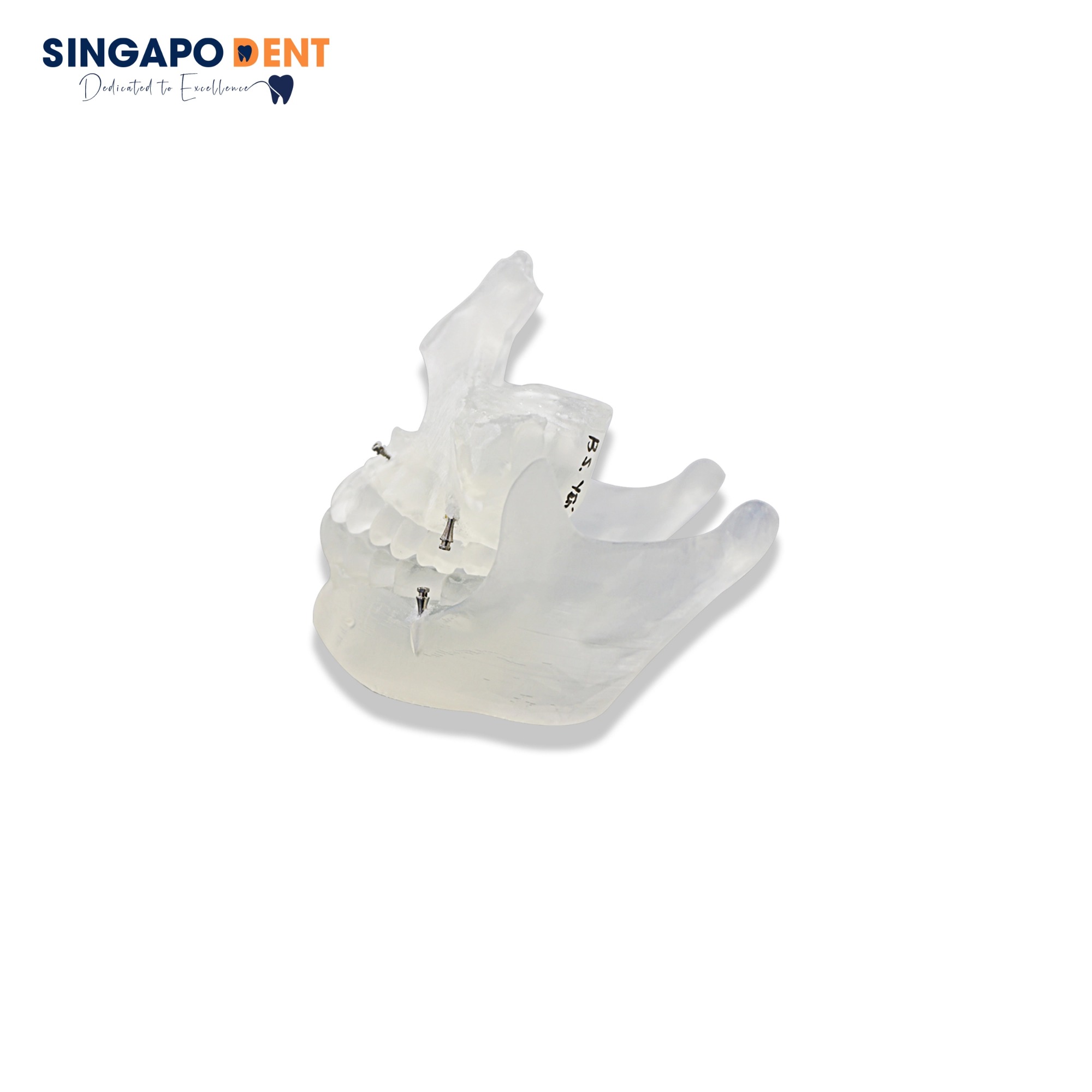 In mẫu hàm dùng tư vấn, thực hành cắm vis