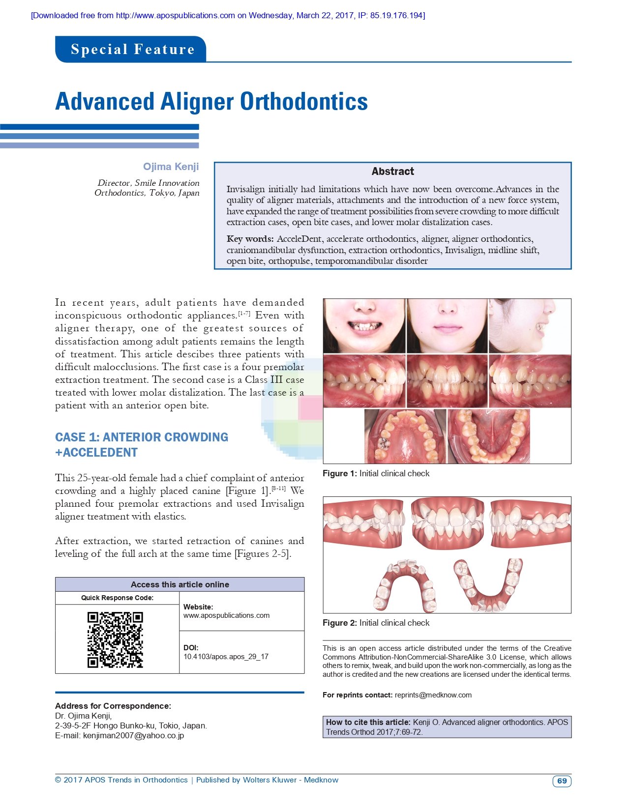 Advanced Aligner Orthodontics