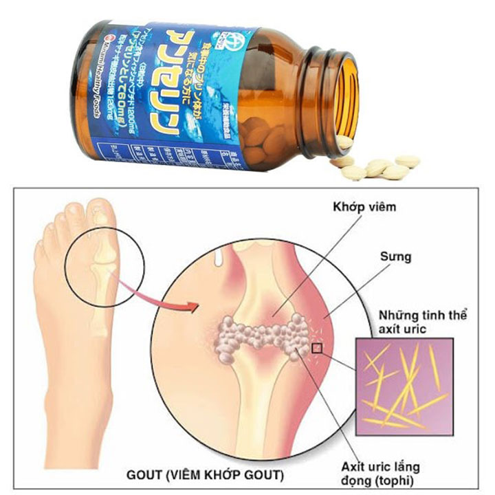 VIÊN UỐNG HỖ TRỢ ĐIỀU TRỊ GOUT, GIẢM CHOLESTEROL ANSERIN MINAMI NHẬT BẢN 240 VIÊN