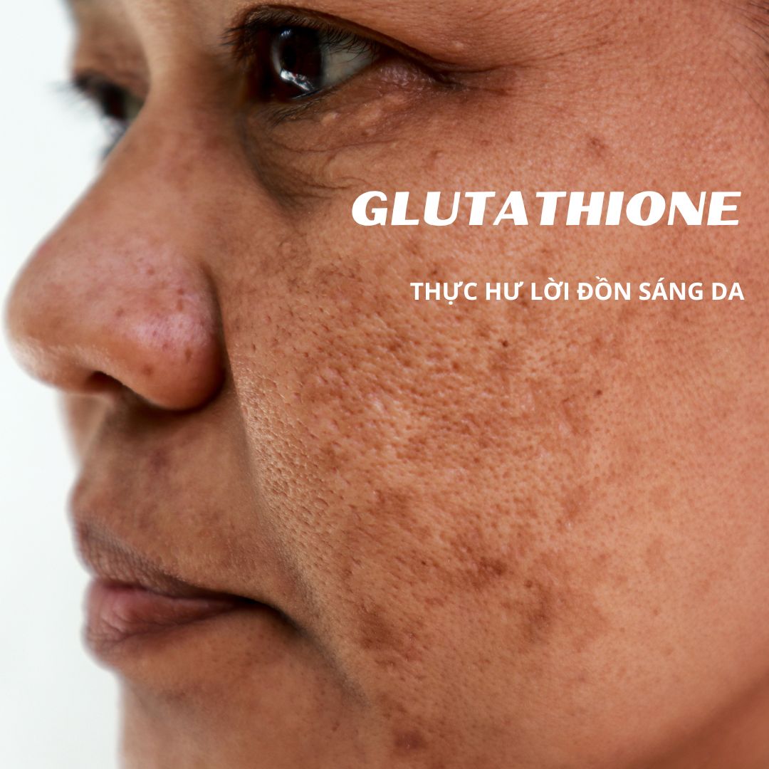 Glutathione - Sự thật trắng da giảm nám có đúng không?