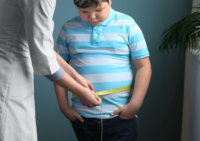 Chế độ ăn hỗ trợ béo phì ở trẻ em