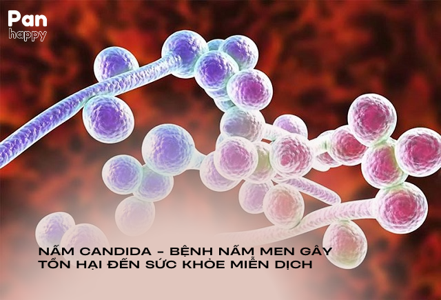 Nấm Candida - bệnh nấm men gây tổn hại đến sức khỏe miễn dịch