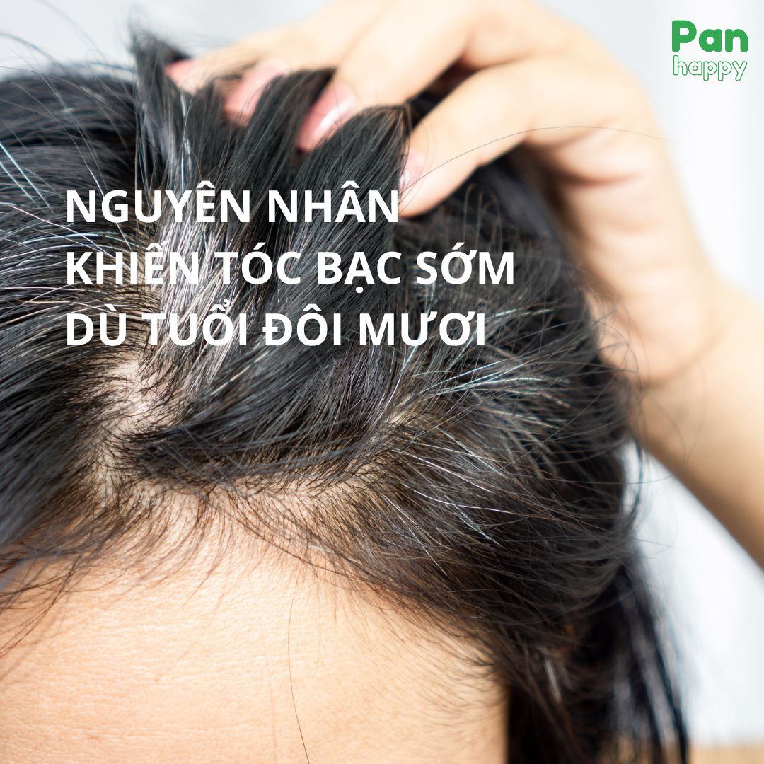 Vén màn sự thật tóc bạc sớm, bạc trắng cả đầu, hói đầu, rụng tóc