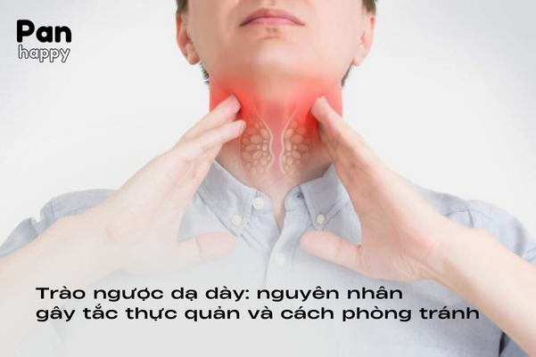 Trào ngược dạ dày: nguyên nhân gây tắc thực quản và cách phòng tránh