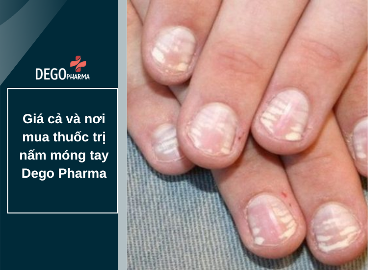 ​​​​​​​Giá cả và nơi mua thuốc trị nấm móng tay Dego Pharma