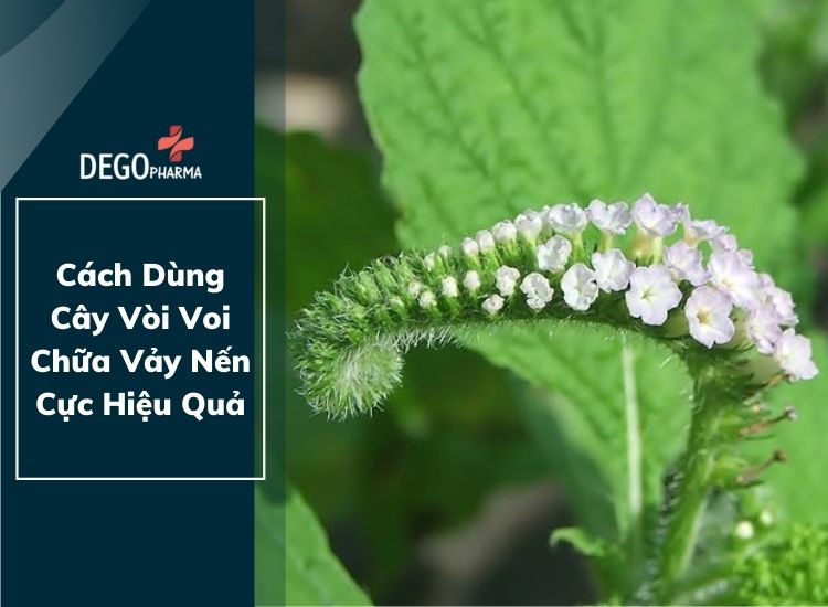 Cách dùng cây vòi voi chữa vảy nến cực hiệu quả