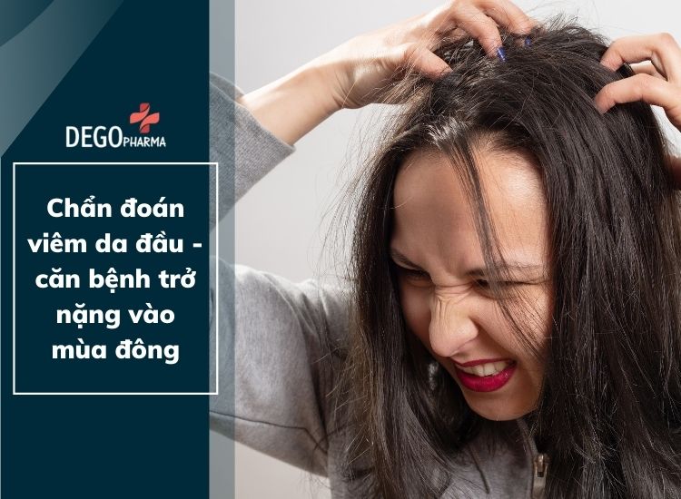 Chẩn đoán viêm da dầu - Căn bệnh trở nặng vào mùa Đông