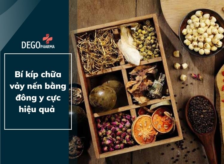 Bí kíp chữa vảy nến bằng đông y cực hiệu quả