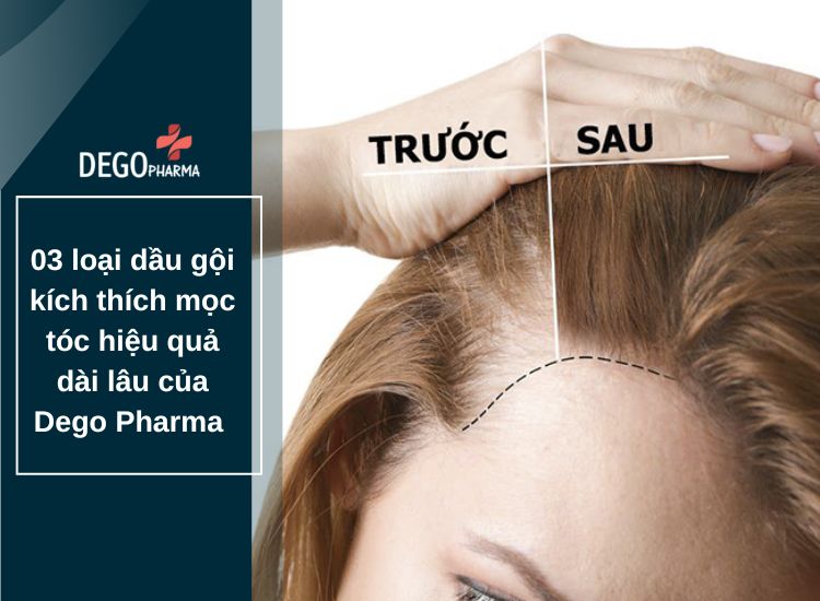 03 loại dầu gội kích thích mọc tóc hiệu quả dài lâu của Dego Pharma 