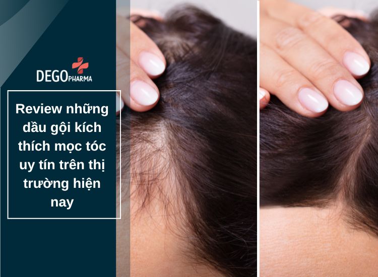 Review những dầu gội kích thích mọc tóc uy tín trên thị trường hiện nay