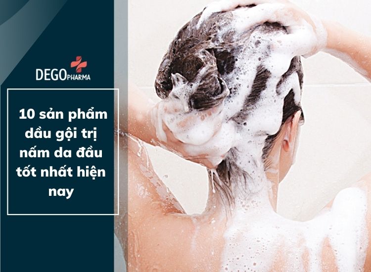 [Review] TOP 10 sản phẩm dầu gội trị nấm da đầu tốt nhất hiện nay