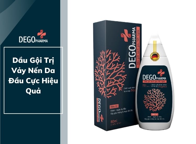 Dầu Gội Trị Vảy Nến Da Đầu Cực Hiệu Quả - DEGO PHARMA