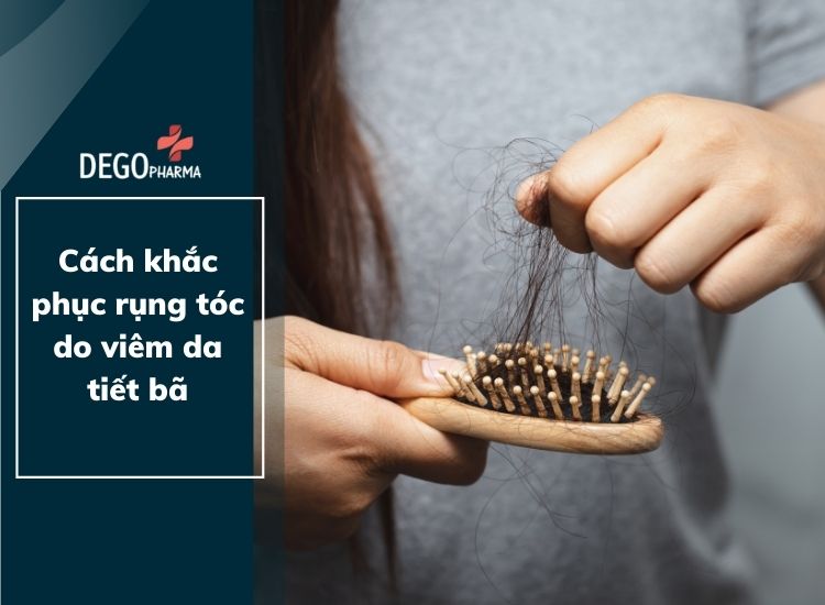 Cách khắc phục rụng tóc do viêm da tiết bã