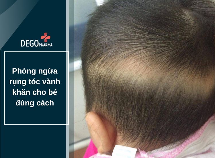Phòng ngừa rụng tóc vành khăn cho bé đúng cách