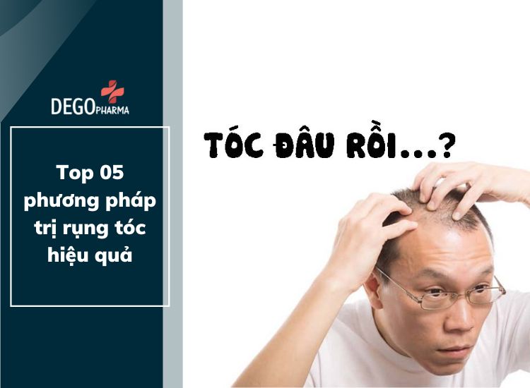 Top 05 phương pháp trị rụng tóc hiệu quả