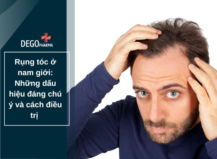 Rụng tóc ở nam ɡiới: Những dấu hiệu đáng chú ý và cách điều trị 