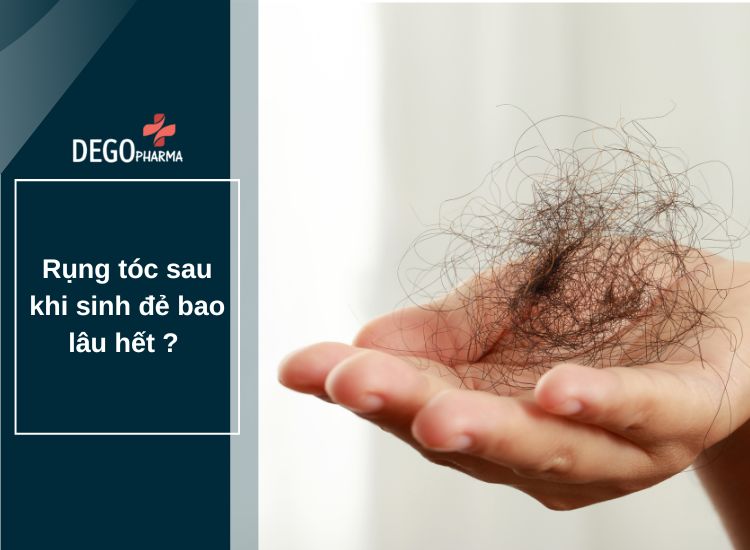 Rụng tóc sau khi sinh đẻ bao lâu hết ?