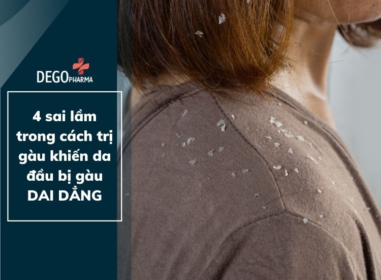 4 sai lầm trong cách trị gàu khiến da đầu bị gàu dai dẳng không dứt