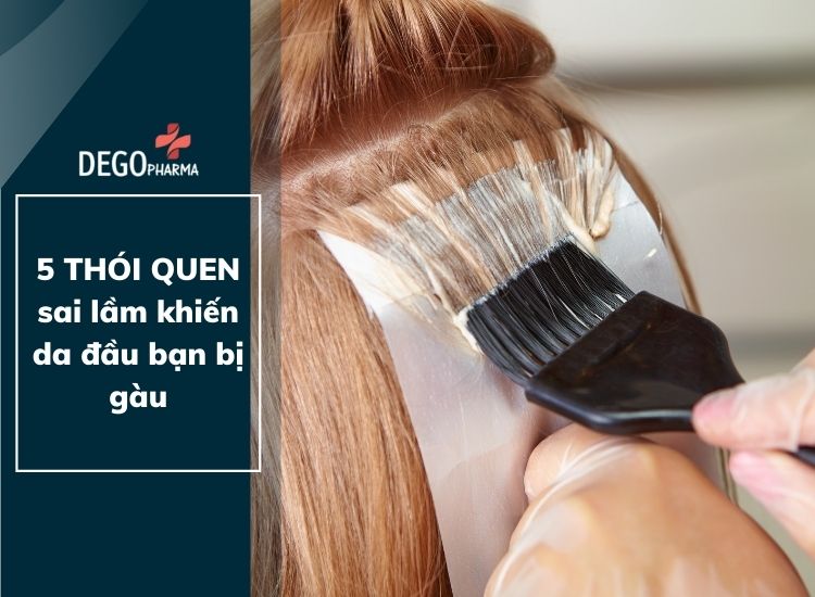 5 thói quen sai lầm khiến da đầu bạn bị gàu