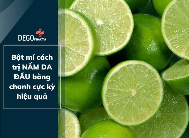 Bật mí cách trị nấm da đầu bằng chanh cực kì HIỆU QUẢ